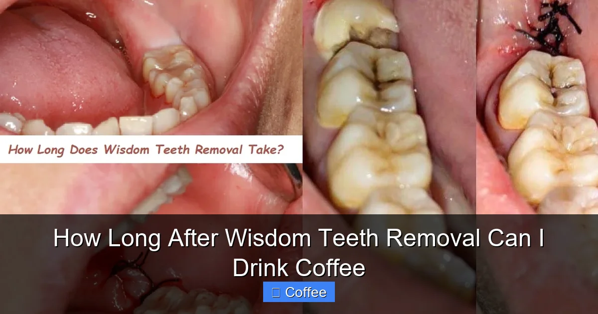 How Long After Wisdom Teeth Removal Can I Drink Coffee